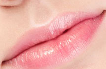 Dermal Fillers